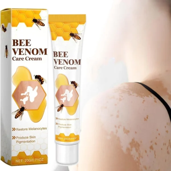 fivfivgo bee venom vitiligo treatment cream | skin repair & hydration