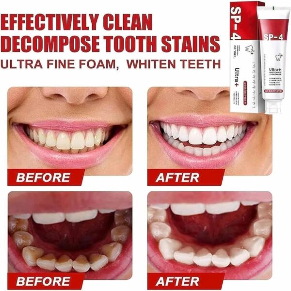 yayashi sp 4 ultra whitening toothpaste | stain remover | fresh breath